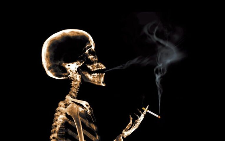 Fumer comme cause de maux de dos dans la région de l'omoplate
