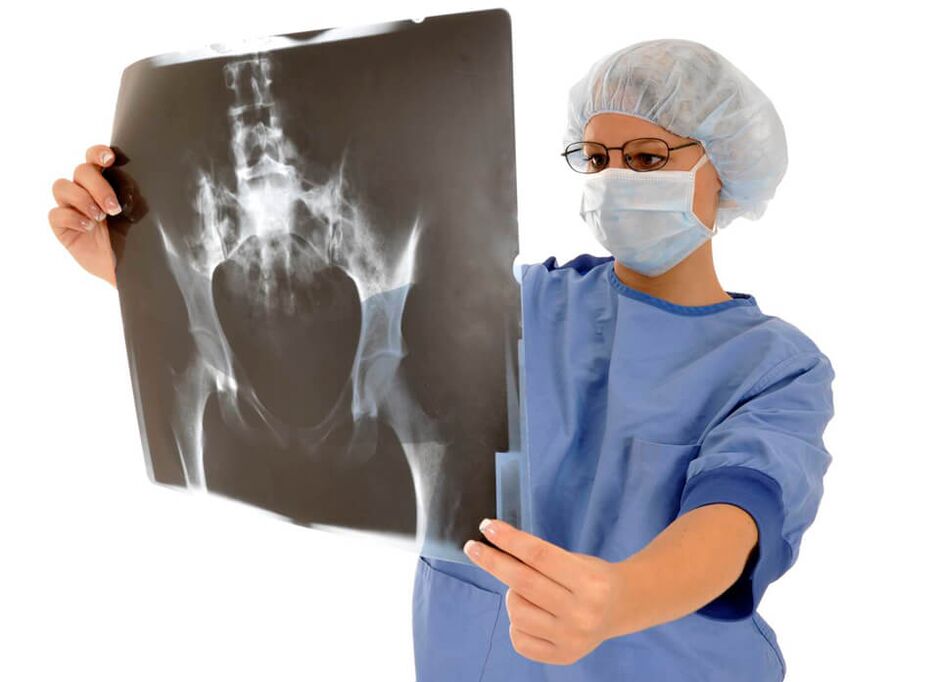 Une radiographie de l'articulation de la hanche aide le médecin à déterminer la cause de la douleur