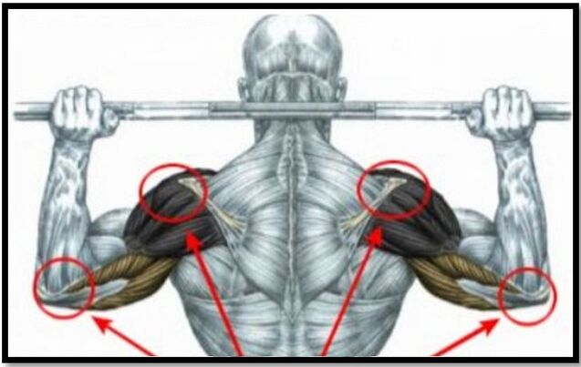 La tension exercée sur les muscles de l'épaule et du coude est l'une des causes de l'arthrose de l'articulation de l'épaule. 