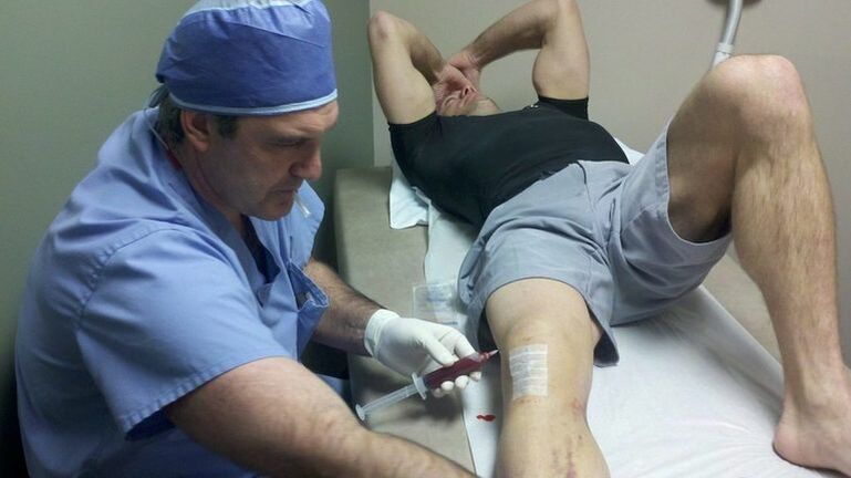 Traitement de l'arthrose de l'articulation du genou